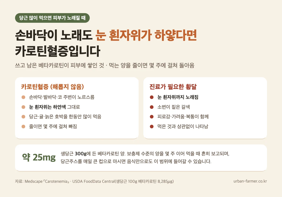 당근 많이 먹으면 피부 노래짐 - 카로틴혈증은 손바닥·발바닥만 노랗고 눈 흰자위는 하얀색, 황달과 구별법